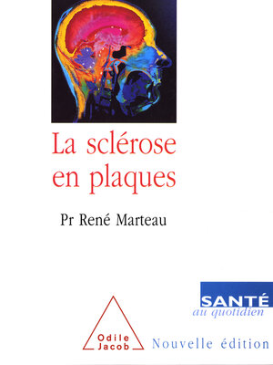 cover image of La Sclérose en plaques